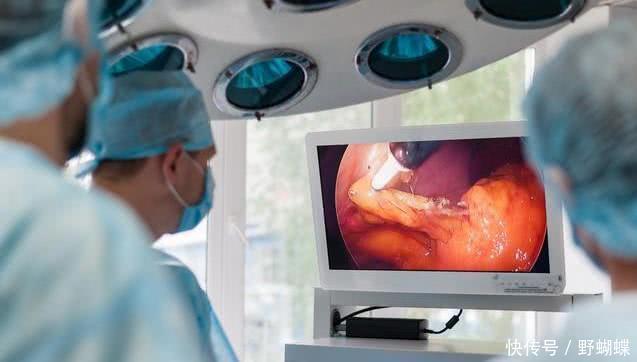 上身|母女二人双双查出胃癌,医生2样东西吃的太多,很容易惹癌上身