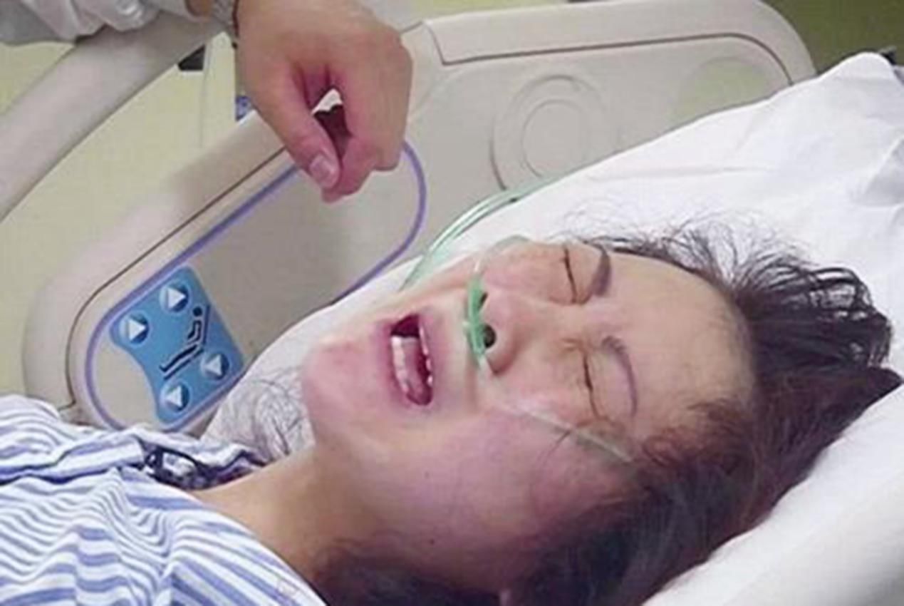 分娩|顺产也可能“挨一刀”,自然撕裂和人为侧切,孕妈更愿意接受哪个