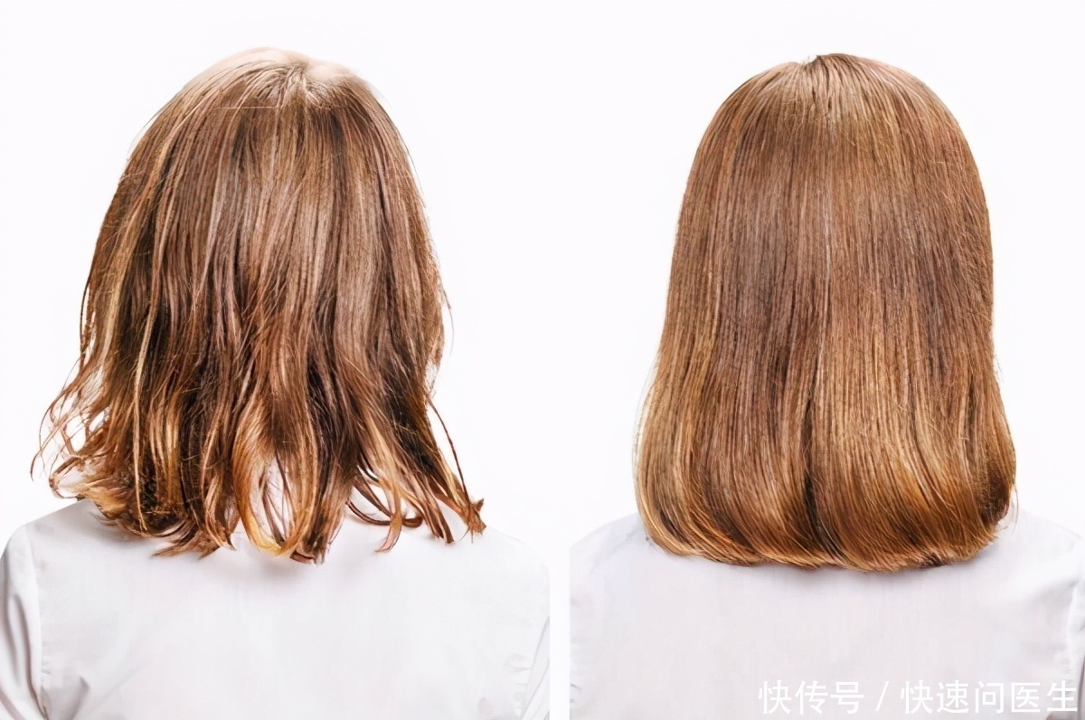 植物性|染发可能致癌?存在一定风险,一年最好不要超过两次