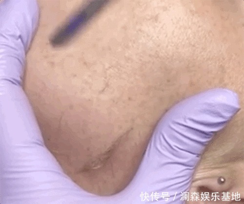 拍照|除了拍照磨皮还不够，欧美女生迷上了人工磨皮