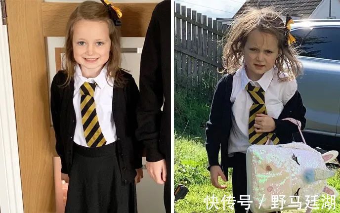 皮肤病|宝宝衣服要这样洗,才不会得皮肤病!尤其是3岁以下的宝宝