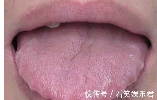 老中医|老中医告诫:6个症状是脾虚信号!艾灸5穴最养脾,脾不虚,病不找