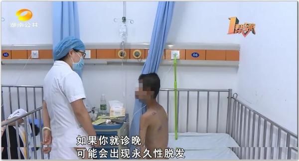 孩子|多名孩子中招，头皮溃烂脱发，家里养宠物的请注意