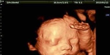 胎动|“孕28周”, 产前第一道坎, 5件重要事情都发生在这个时期