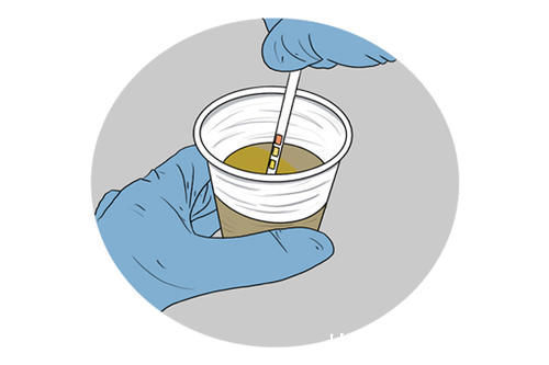 嘌呤|有痛风也能吃肉,号称尿酸“灭火器”,2种肉可常吃,排酸补钙