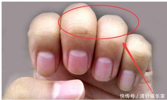 當身體出現以下五種癥狀，多半是長壽的象征，別以為是生病！