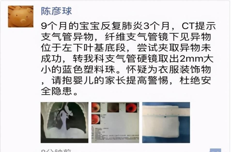 差点让孩子窒息，这4种衣服绝对不能留