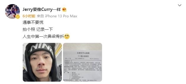 刘东|CBA变武斗场?两大名将中招,一个鼻梁3处骨折,一个嘴巴缝12针
