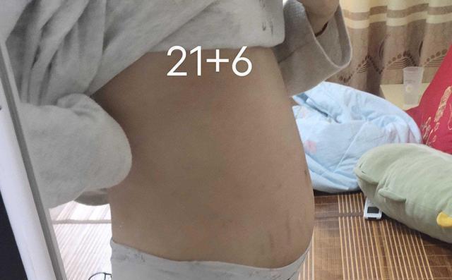 宝妈|这几种水果尽量别给娃吃,尤其是1岁左右的宝宝,辅食添加需谨慎