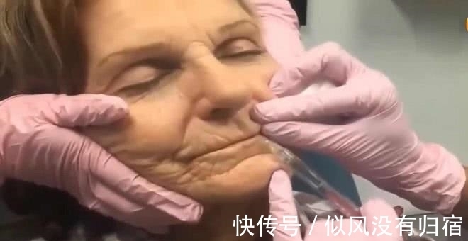 老妇人|老妇人嫌自己的脸太老,希望变得年轻,竟然去医院整容