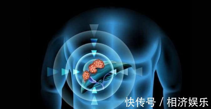 口臭|肝不好的人，2点地方会有前兆，一般人不留意，肝癌悄然而至