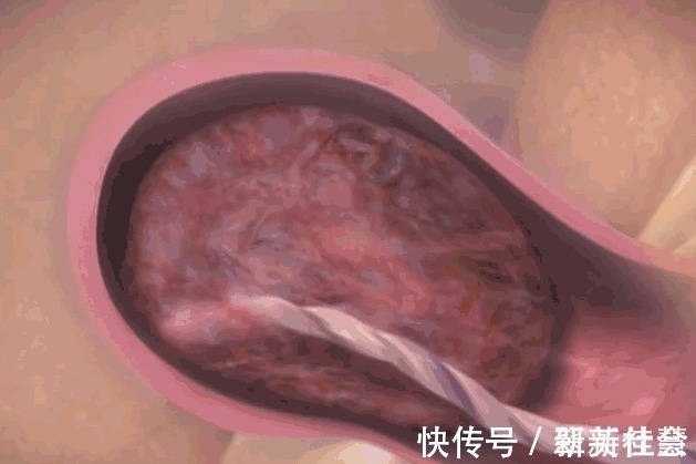 高龄产妇|顺产到底有多疼3张图让你一目了然，妈妈太不容易，请善待她们