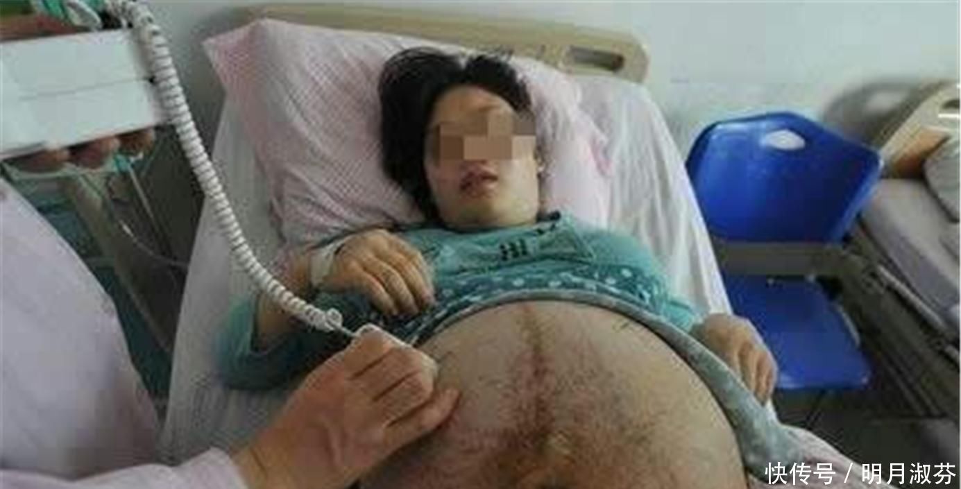 顺产|90后孕妈顺产三胞胎,缝合时大喊“还有一个”,把医生都逗笑了