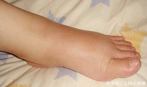 晨起|俗话说“筋长一寸、延寿十年”,每天晨起拉拉筋会有哪些好处?