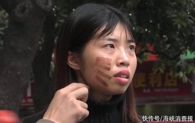 爱美之心 女子做光子嫩肤，却被烫出“五条杠”，店家这种情况不存在赔偿