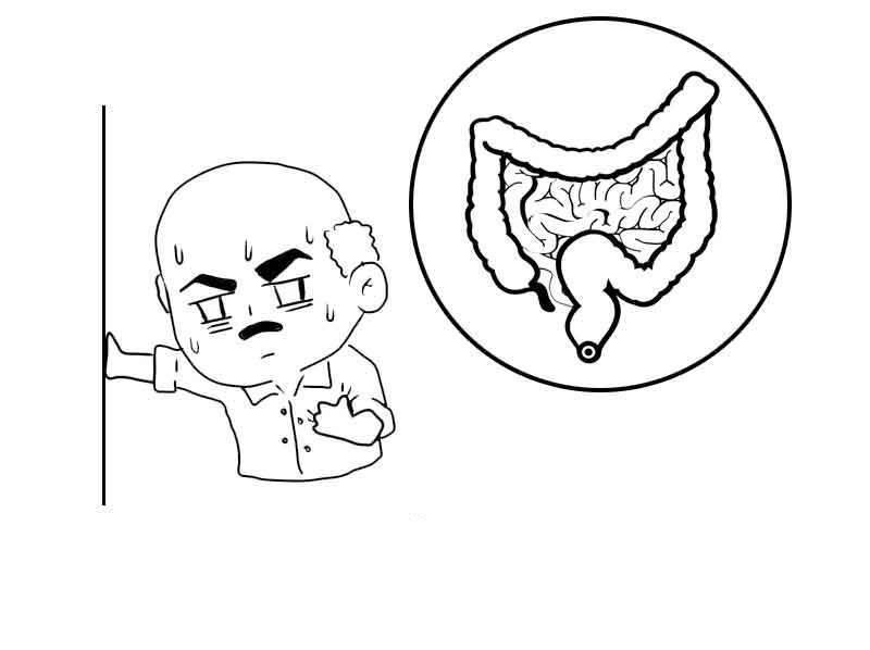 大便|肠癌都是拖出来的?有这3个表现,是肠道在求救!越早做肠镜越好