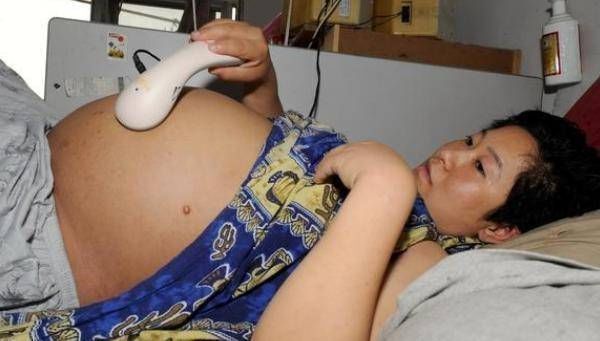 剖腹产|产科医生告诉你,这5种情况一定是剖腹产不是每个怀孕的母亲都能生孩子