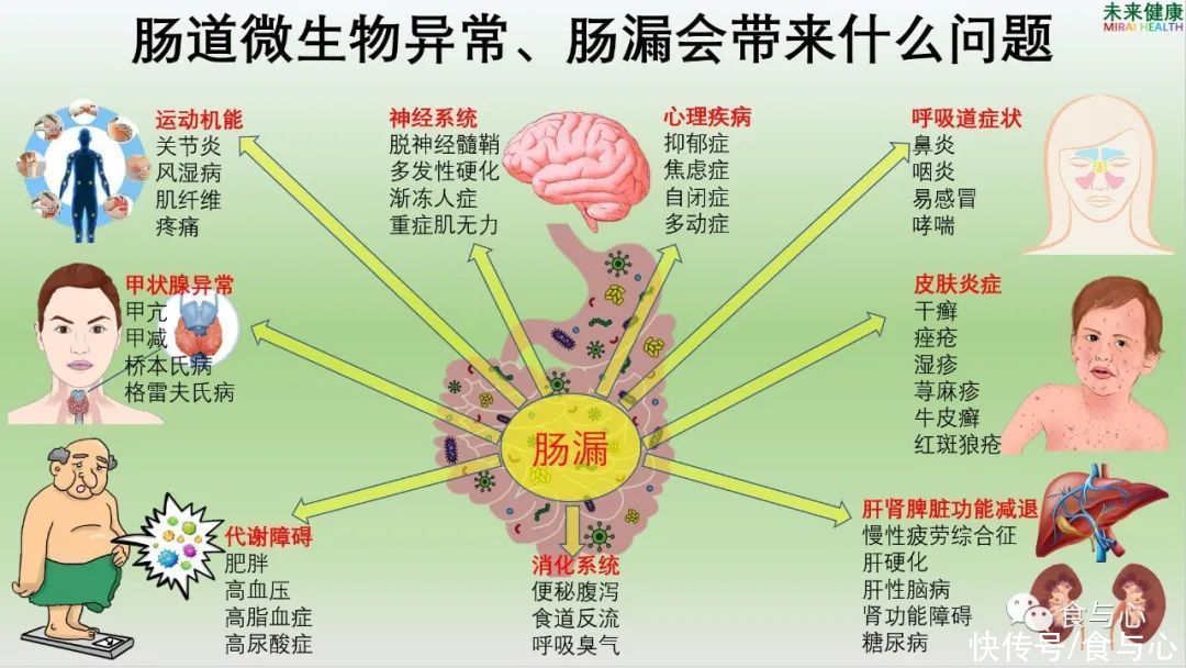 碳水化合物|你在为谁吃饭？看懂了就知道人为什么会生病 (1)