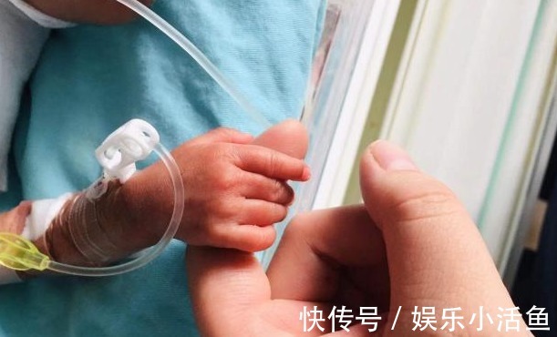 宝宝|850克!超低体重早产!历时106天守护,大理这名迷你宝宝出院啦