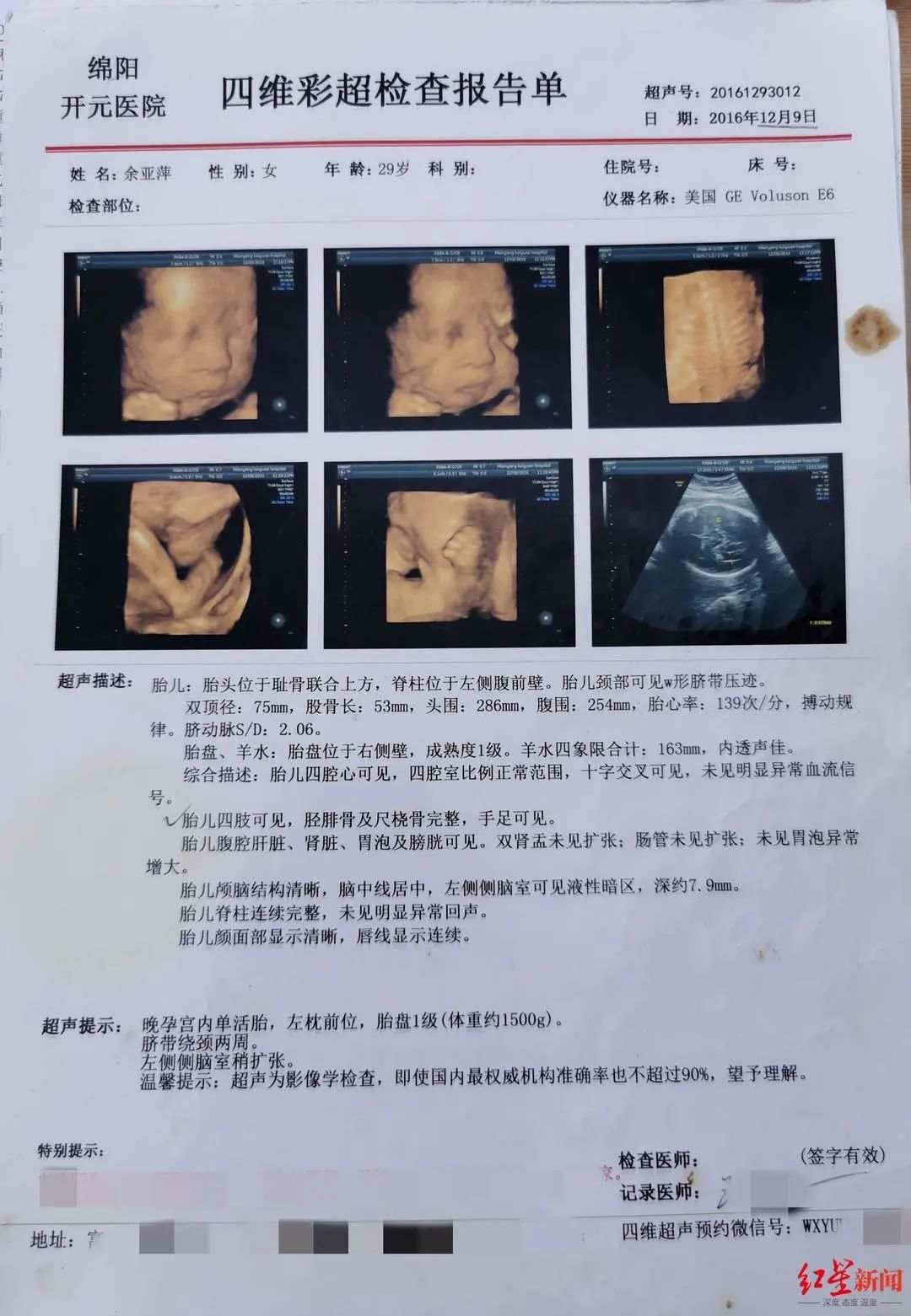 绵阳开元医院|产检四维彩超正常，孩子出生却左小腿畸形，医院漏诊赔偿百万