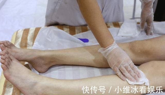 女性|为什么有的女性体毛旺盛，有的却一点也没有？哪种情况好？