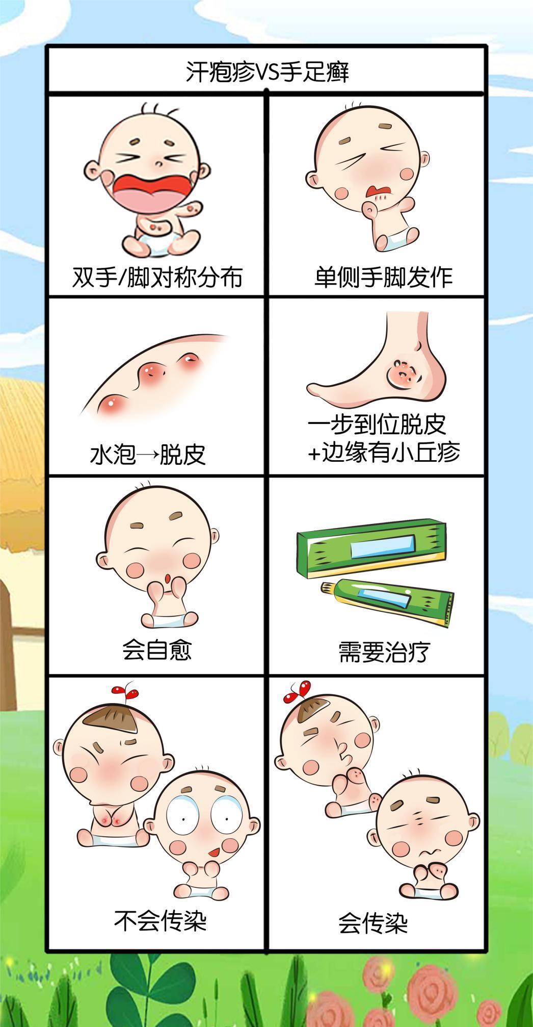 汗疱疹|夏天宝宝手上长的小水泡是什么?这还是宝宝的手吗?要紧不?