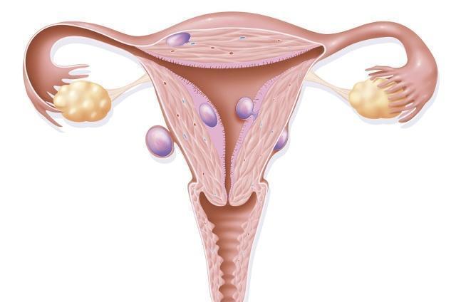 子宫|子宫好不好看脸,如果没有3种“表现”,你的子宫还健康