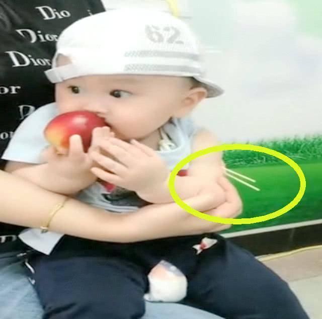 明敏|宝宝打针,全程只知道吃,护士都被逗笑了,网友一个妥妥的吃货