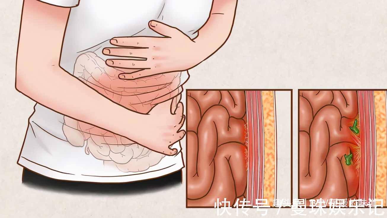 蔬菜|便秘最怕4种食物！隔三差五吃一次，比香蕉都管用清肠还排毒