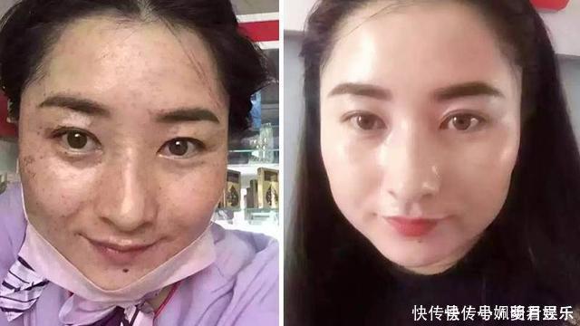 敷脸|牛奶加上常见的“它”敷脸，不出15天淡斑又嫩肤，色斑妹子的福音