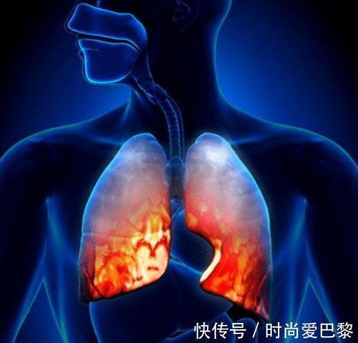 雪梨|肺不好不能吃茄子？5种食物不妨多吃，养肺护肺，肺好百病消！