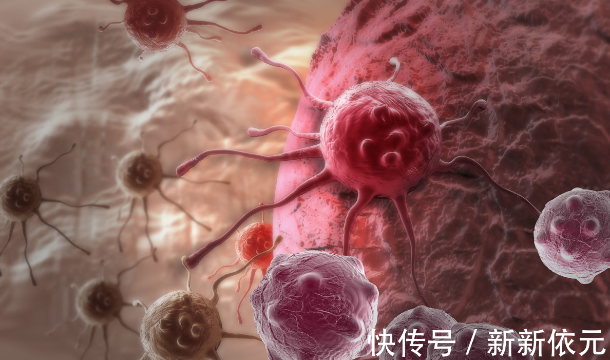 感染性疾病|诊断肺癌后有人不知不觉活过3年,有人炸油条做生意活过5年