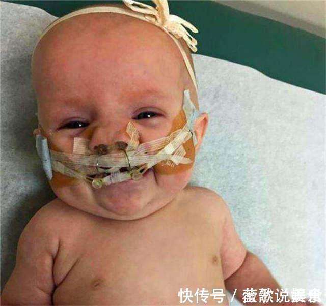 宝宝|24岁宝妈生下“兔子宝宝”,丈夫劝她放弃,手术后妈妈掩面而泣