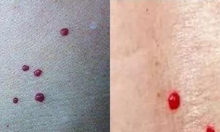 癌症|警告不分男女,身体若出现这3个症状,或许是癌症找上了你早自检