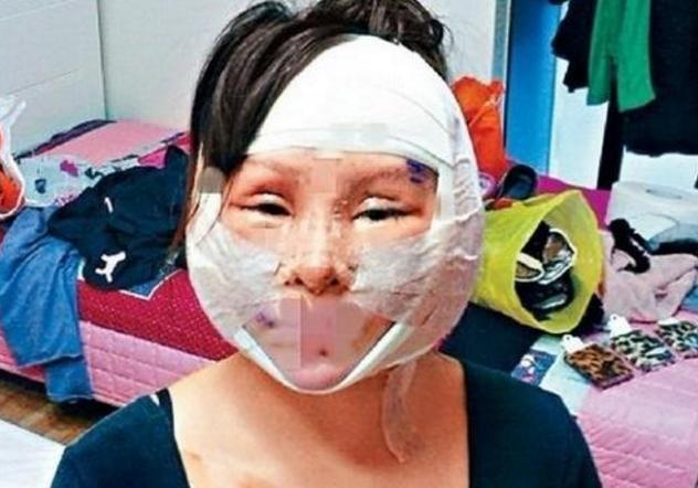 整容 她16岁开始整容,花400多万做过200多次手术,如今成了这样
