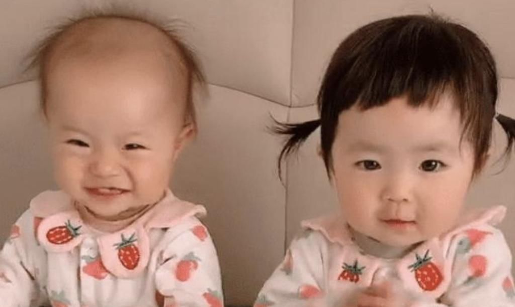 指甲油|最好认的双胞胎走红,发量一个随妈一个随爸,网友:妈妈真偏心