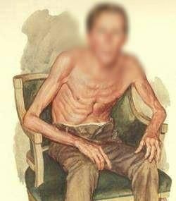 疼痛|医生说,体内有癌,身体往往有4个标志,具体都是什么呢