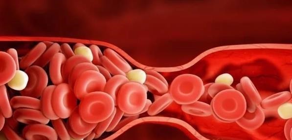 葛根|它被称为天然的“阿司匹林”,每天泡水喝,血管干净血栓悄悄走远