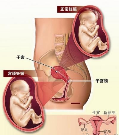 状态可能|孕妇的“肚量”那么大，内脏会受到挤压吗？