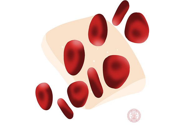 嚴重貧血吃什么食物