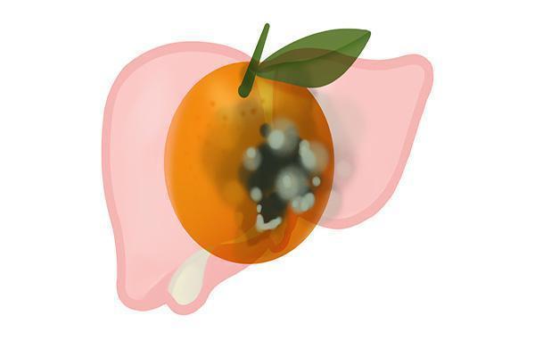 中药|为什么肝癌的发病率越来越高?预防肝癌,应该怎么做?