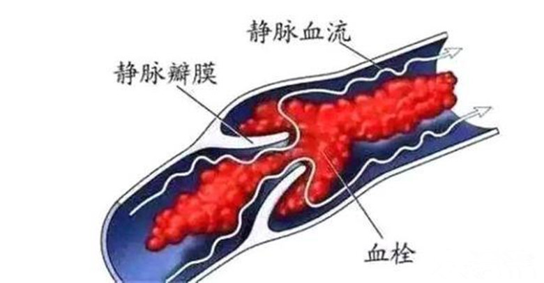 剖宫产史|一胎二胎剖腹产，第三胎怀孕有6个风险