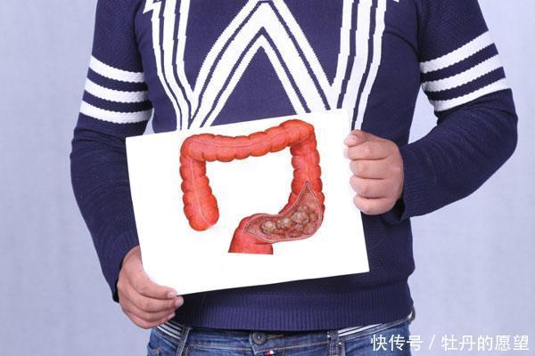 大便不成形，有人说是肠癌，有人说是湿气，究竟是什么原因