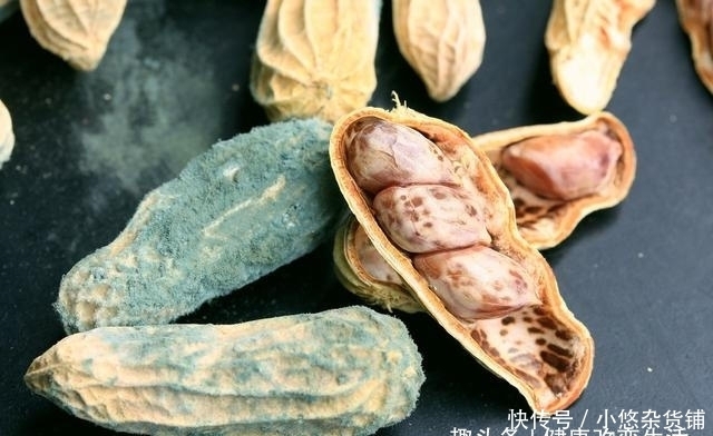 肝会|肝癌多是“吃”出来的,这5样东西,如果不碰,你肝会更健康!