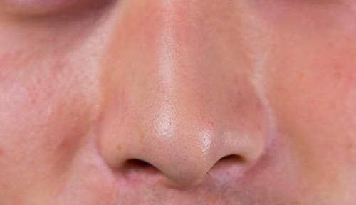 鼻毛太长,冒出鼻孔,要拔掉或剪掉吗为什么鼻毛会冒出鼻孔