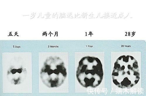 孩子|宝宝智商高不高,看6岁前有没有四个特征?中一条恭喜家长!
