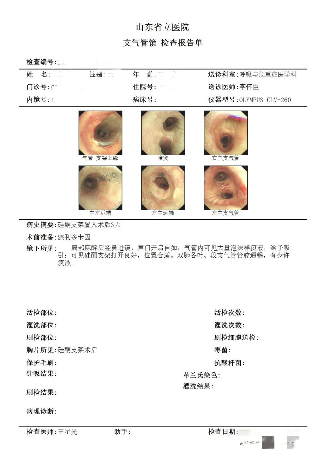 气管镜|【技术创新 走在前列】山东第一医科大学附属省立医院多学科联合完成首例硬质气管镜下Y型硅酮支架置入术