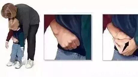 宝爸|2岁男童被饼干卡喉咙窒息,送入医院抢救无效,父母只能放弃治疗