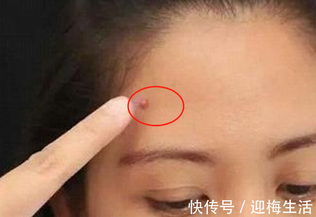 子宫|子宫好不好,看脸就知道脸若有4个不良现象,要注意保养子宫