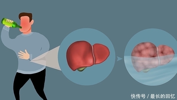 喝酒|晚上酒喝多了,次日醒来还满身酒味,与转氨酶有关系?医生解答